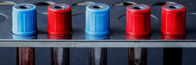 Типы аккумуляторов: свинцово-кислотные и AGM